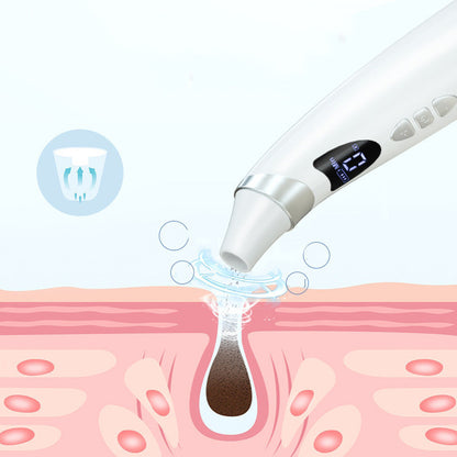 Visual Suction Blackhead Remover