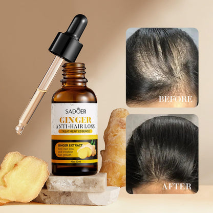 Ginger Hair Growth Oil